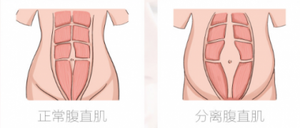 ECHǣ޸ֱĺð