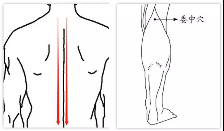 可沿着"大椎穴夹脊穴"的方向刮痧,或刮揉委中穴.