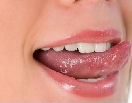舌头溃疡怎么治疗？